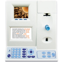 Automated Sperm Quality Analyzer